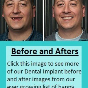 before-and-afters