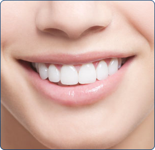 cosmetic-dentistry-preston