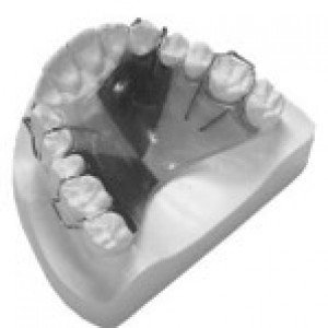 orthodontics1