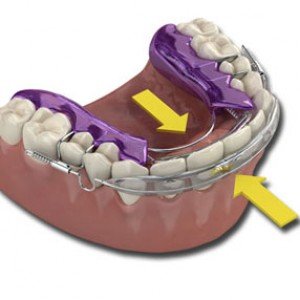 top_bottom_aligner_ARROWS2